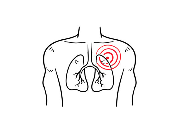 Download Doodle  Pneumonia Icon - Icon Collection